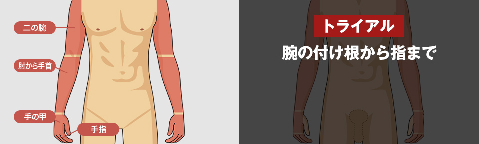 トライアル 腕の付け根から指まで <?php echo $trial_arms; ?>円