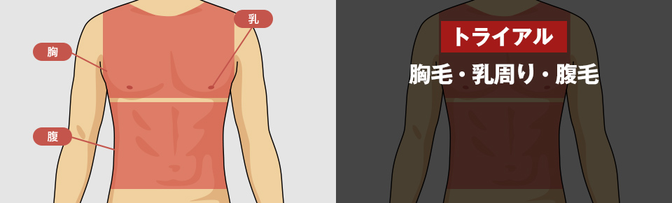 トライアル 胸毛・乳周り・腹毛 <?php echo $trial_body; ?>円