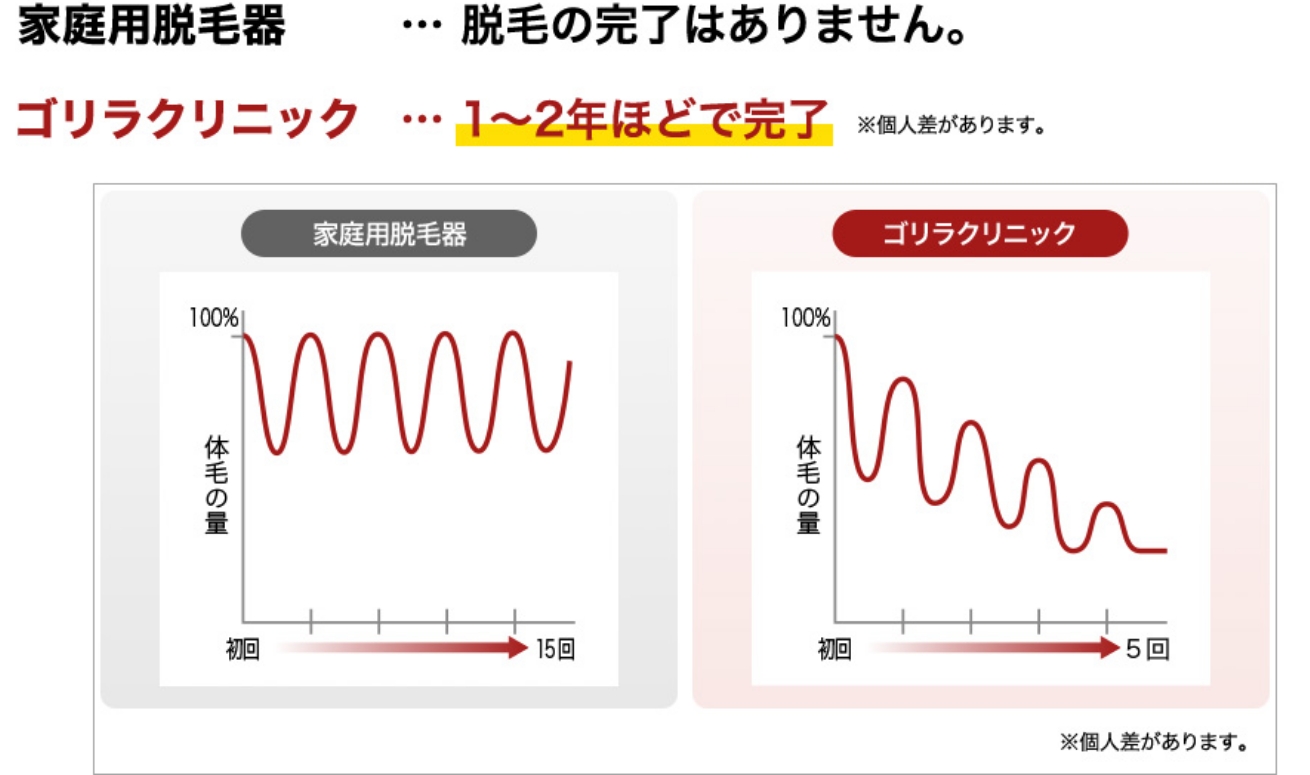 家庭用脱毛器…脱毛の完了はありません。 ゴリラクリニック…1年～2年ほどで完了 ※個人差がございます