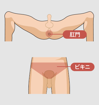 肛門 ビキニ