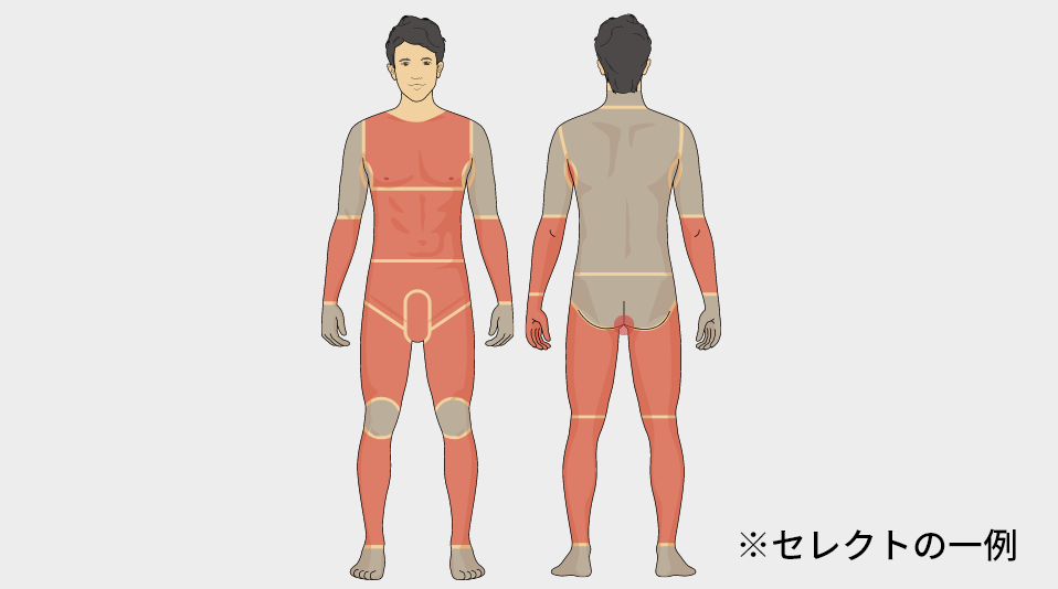 セレクト全身脱毛