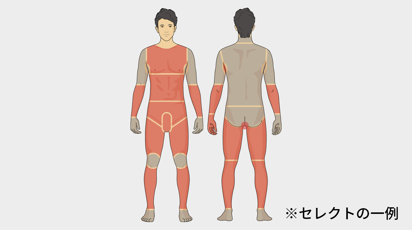 セレクト全身脱毛