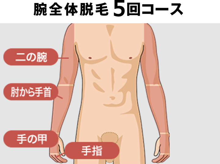 腕全体脱毛の料金