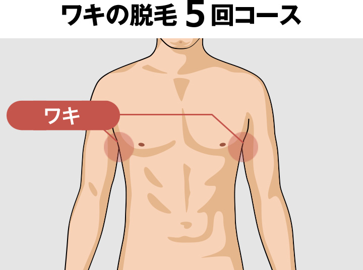 脇（ワキ）の脱毛料金