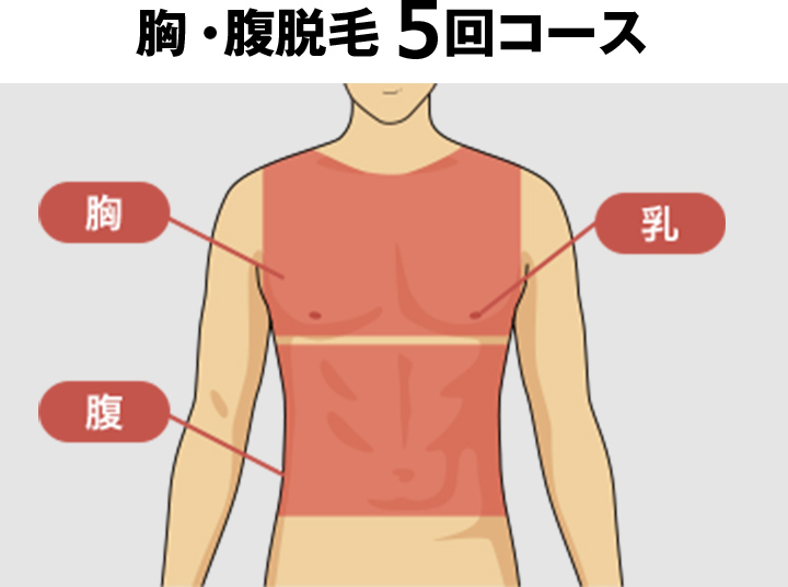 胴全体脱毛の料金