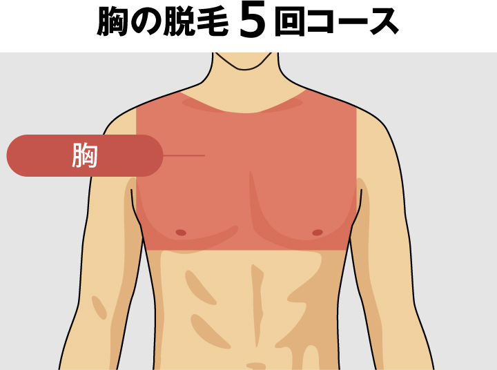 胸毛の脱毛料金