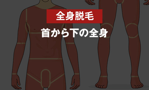 ゴリラクリニックの全身脱毛 <?php echo $price_all_total; ?>円