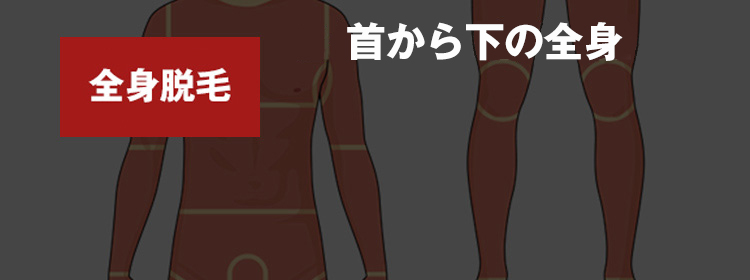 ゴリラクリニックの全身脱毛 <?php echo $price_all_total; ?>円