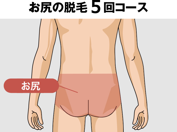 お尻（ケツ毛）の脱毛料金