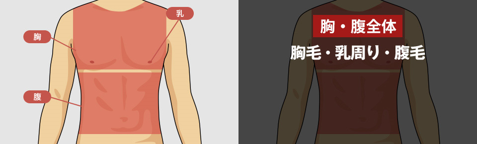 全身脱毛の医療レーザー脱毛 胸毛・乳周り・腹毛 <?php echo $price_body_total; ?>円