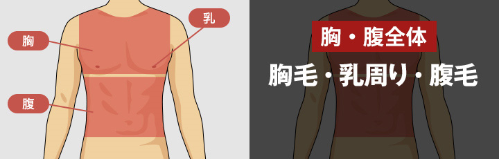 全身脱毛の医療レーザー脱毛 胸毛・乳周り・腹毛 <?php echo $price_body_total; ?>円