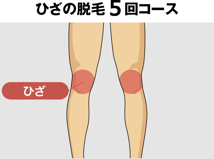 ひざの脱毛料金
