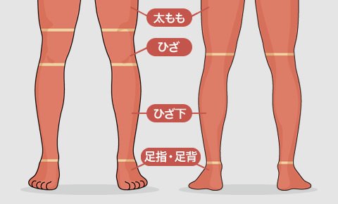 脚全体脱毛の料金