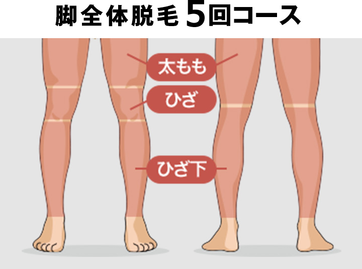 脚全体脱毛の料金