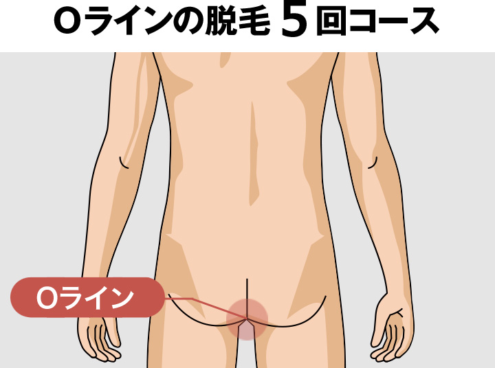 Oライン周辺の脱毛料金