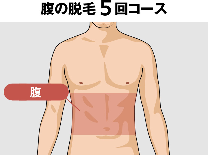 腹毛（ギャランドゥ）の脱毛料金